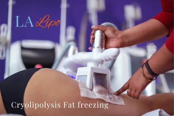 women getting fat freezing Camden Town