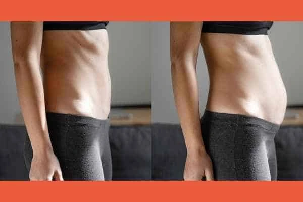 LA-EMS Body Sculpting results Camden Town
