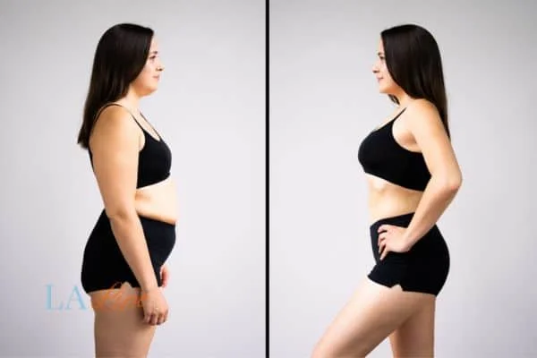 link between body image and mental health Camden Town