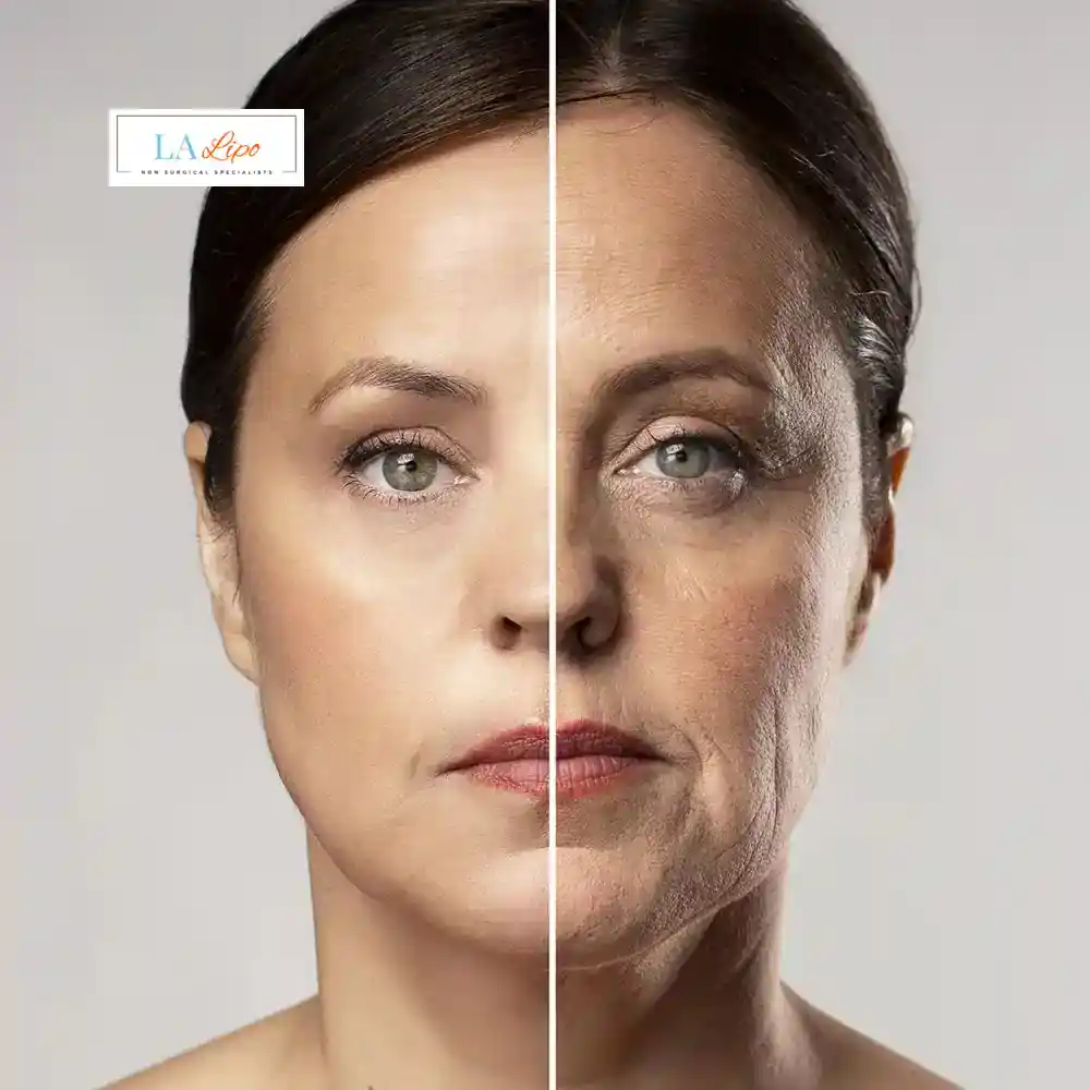How Can You Tell If Non-Surgical Skin Tightening Is Right for You Camden Town?