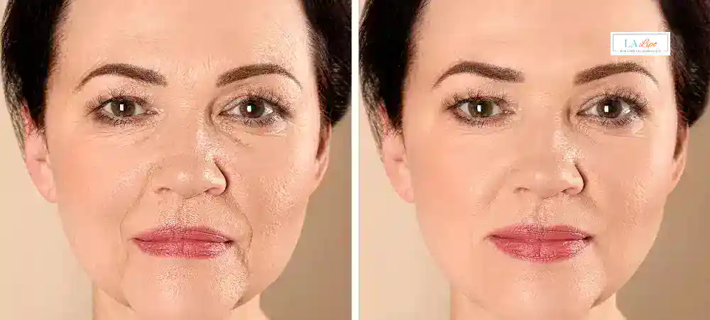 Why Aren’t My Skincare Products Making My Sagging Skin Look Firmer Camden Town?