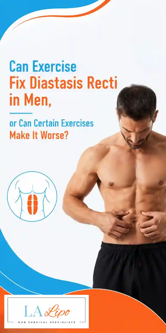 Can Exercise Fix Diastasis Recti in Men, or Can Certain Exercises Make It Worse Camden Town?